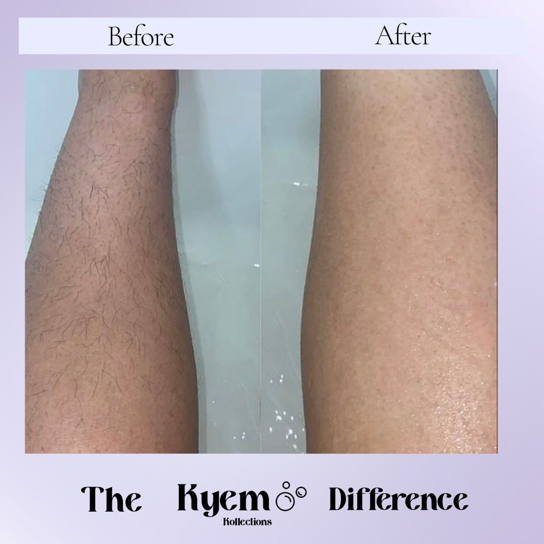 Hairless and Smooth Bundle