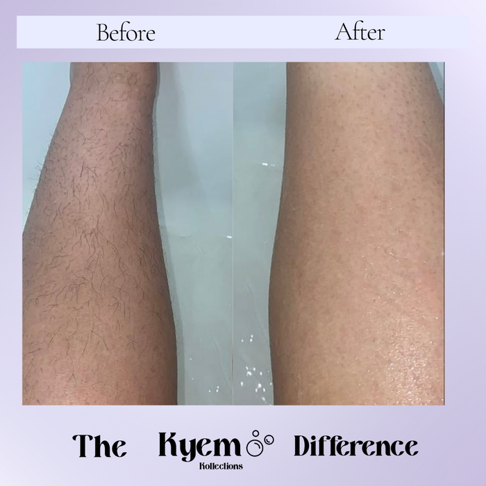 Hairless and Smooth Bundle